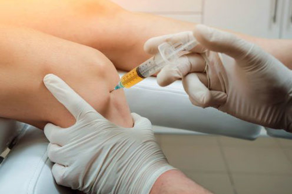 Joint Injection