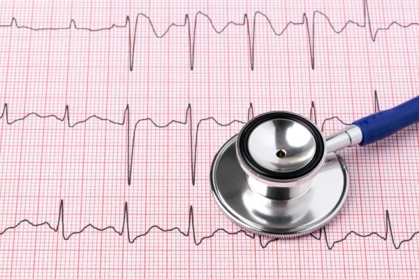 Electrocardiogram (ECG)