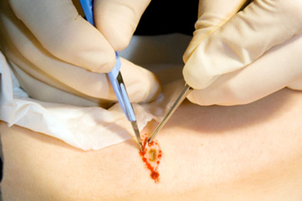 Minor Surgery